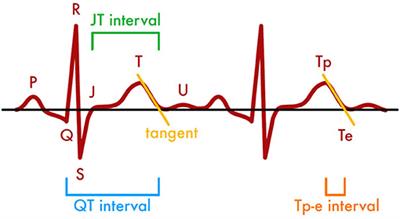 Abnormal Cardiac Repolarization in Thyroid Diseases: Results of an Observational Study